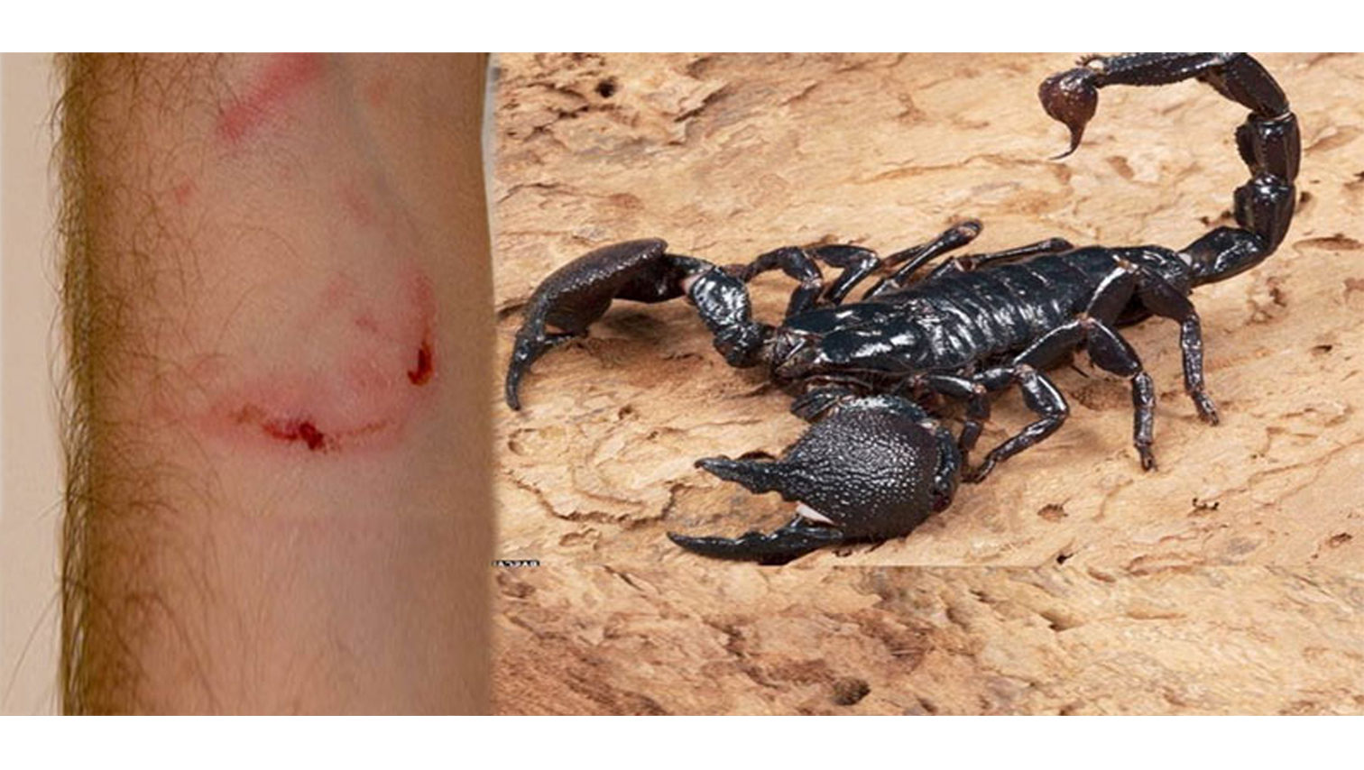 15-year old teen stung by scorpion at Divine Mercy Shrine